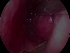 Одноразовый сверхмаленький и гибкий неврологический зонд PLA407